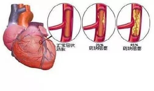 高电位厂家